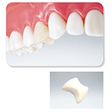 ハイブリッドセラミックス